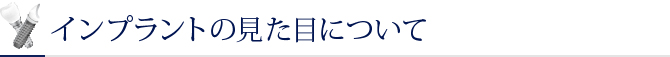 インプラントの見た目について